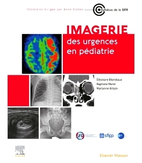 预订 Imagerie des urgences en pédiatrie 儿科急诊影像: 9782294780301