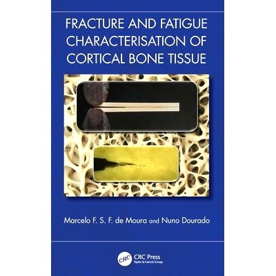 预订 Fracture and Fatigue Characterisation of Cortical Bone Tissue