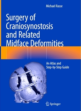 预订 Surgery of Craniosynostosis and Related Midface Deformities: An Atlas and Step-by-Step Guide 颅缝早闭及相关面中部畸