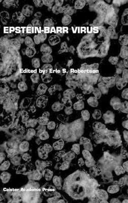 [预订]Epstein-Barr Virus 9781904455035