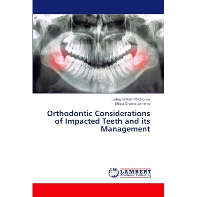 预订 Orthodontic Considerations of Impacted Teeth and its Management 阻生牙的正畸*及处理: 9786208012328