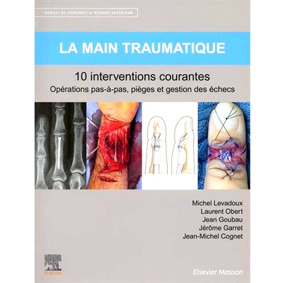 预订 Manuel de chirurgie du membre supérieur. Vol. 2. La main traumatique : 10 interventions courantes : opérations pa