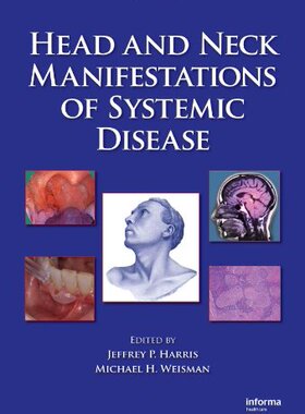 【预订】Head and Neck Manifestations of Systemic Disease