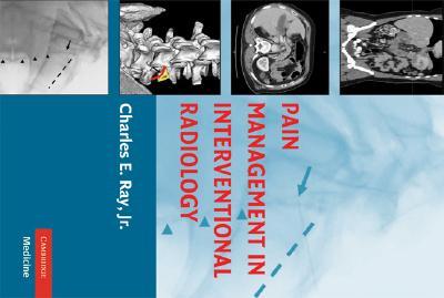 【预订】Pain Management in Interventional Radiology