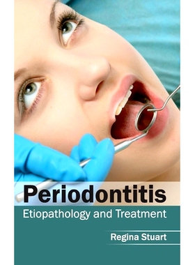 预订 Periodontitis: Etiopathology and Treatment 牙周炎：病理和*: 9781632413192