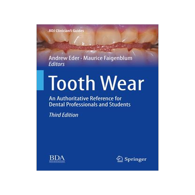 [预订]Tooth Wear: An Authoritative Reference for Dental Professionals and Students 9783030861094