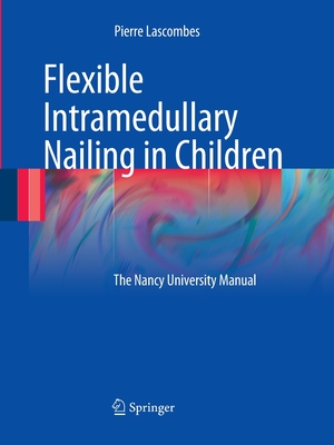 【预订】Flexible Intramedullary Nailing in Children