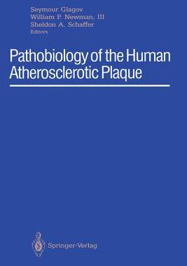 【预订】Pathobiology of the Human Atherosclerotic Plaque