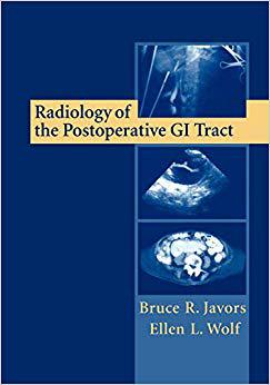 【预订】Radiology of the Postoperative GI Tract