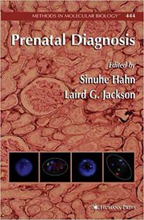 Prenatal Diagnosis 预订