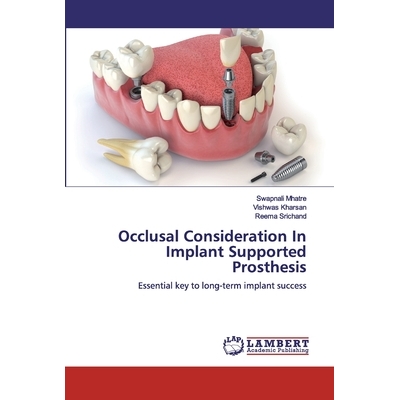 预订 Occlusal Consideration In Implant Supported Prosthesis: Essential key to long-term implant success: 9786200116499