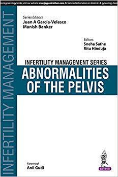 【预售】Infertility Management Series: Abnor...