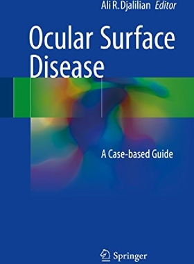 【预订】Ocular Surface Disease