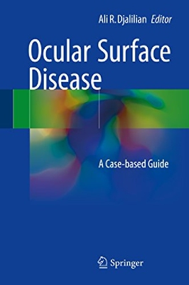 【预订】Ocular Surface Disease