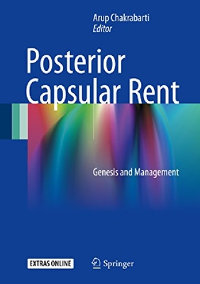 【预订】Posterior Capsular Rent: Genesis and...
