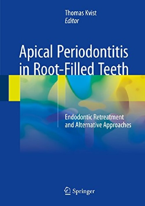 【预订】apical periodontitis in root-filled .
