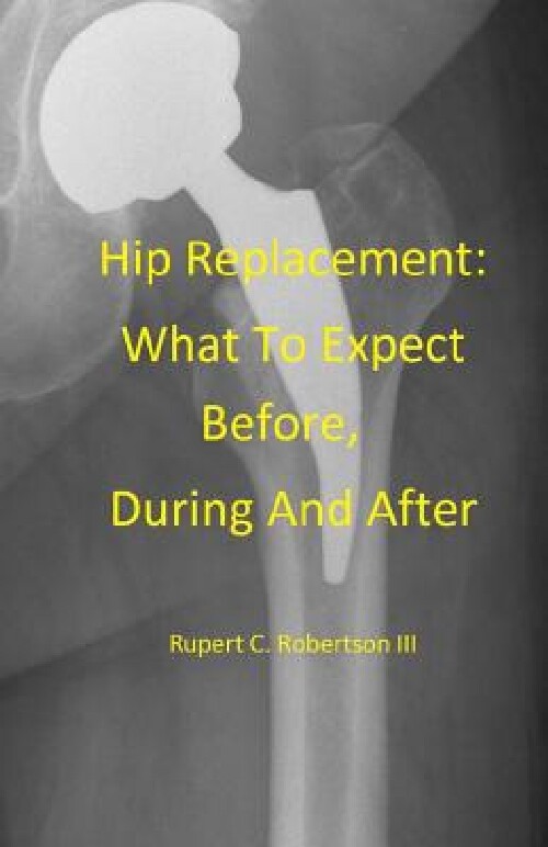 【预订】Hip Replacement: What to Expect Befo...