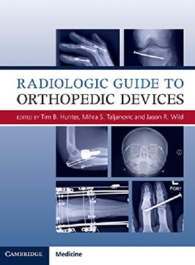 【预订】Radiologic Guide to Orthopedic Devic...