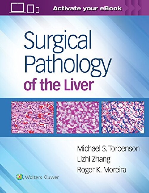 【预订】Surgical Pathology of the Liver