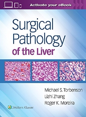 【预订】Surgical Pathology of the Liver