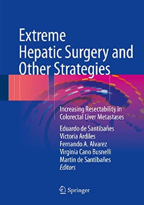 【预订】Extreme Hepatic Surgery and Other St...