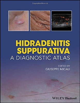 【预订】Hidradenitis Suppurativa