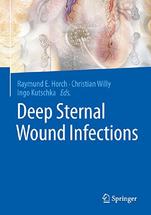 【预订】Deep Sternal Wound Infections
