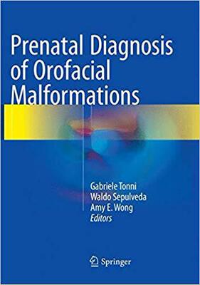 【预售】Prenatal Diagnosis of Orofacial Malf...