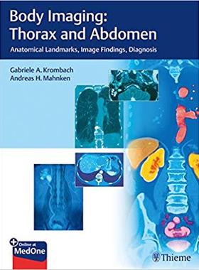 【预售】Body Imaging: Thorax and Abdomen