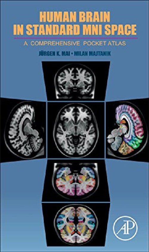 【预订】Human Brain in Standard MNI Space