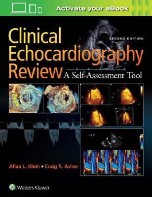 【预订】Clinical Echocardiography Review