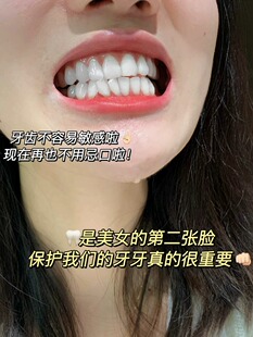 脱敏专用牙膏抗敏美白去口臭官方保正品正品牙齿酸软抗过敏防发酸