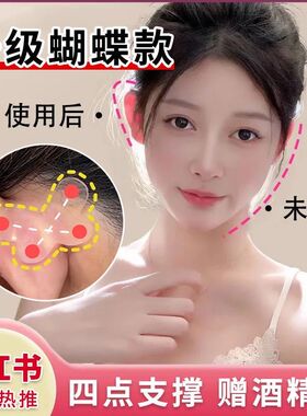 蝴蝶精灵耳贴强支撑隐形不痛女固定招风耳矫正器立耳定型直播神器