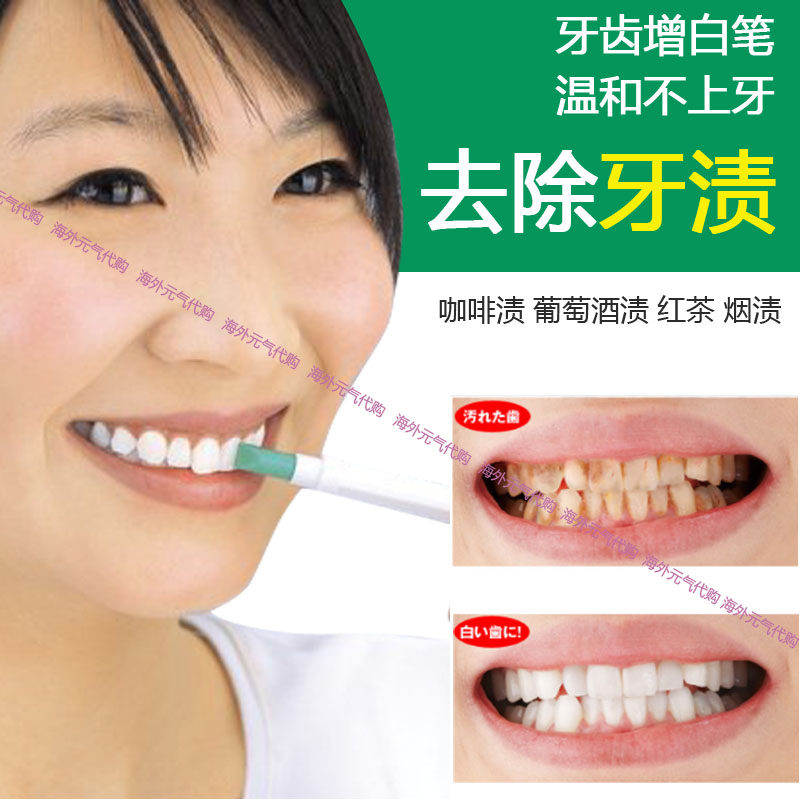 日本清洁去渍笔牙齿橡皮擦去牙垢牙渍烟渍茶渍黄牙污垢牙齿美白笔