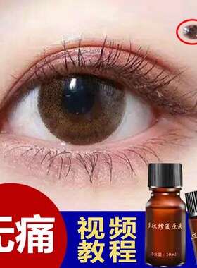 点斑水点雀斑水脸部祛遗传斑老年斑黑痣痦子药水无痕正品美容金水