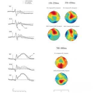 Eyelink1000数据分析眼动实验眼动程序 处理脑电肌电眼特征提取