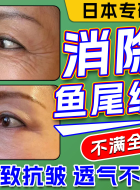去眼角鱼尾纹贴眼角褶皱淡化细干纹抗皱提拉紧致睡眠不足去黑眼圈
