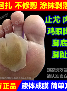 脚医生尤洛清去除脚底止尤鸡眼膏贴跖疣液老茧脚垫鸡尤净胼胝肉刺