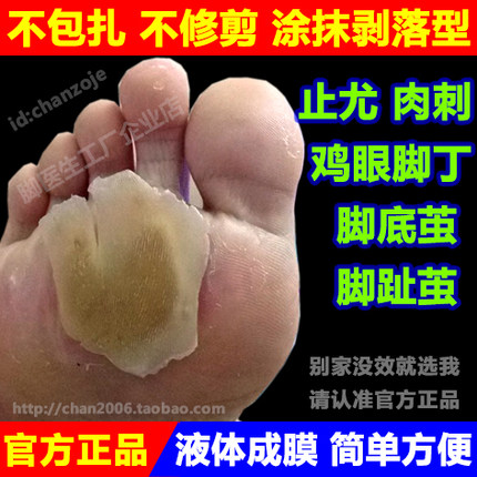 脚医生尤洛清去除脚底止尤鸡眼膏贴跖疣液老茧脚垫鸡尤净胼胝肉刺