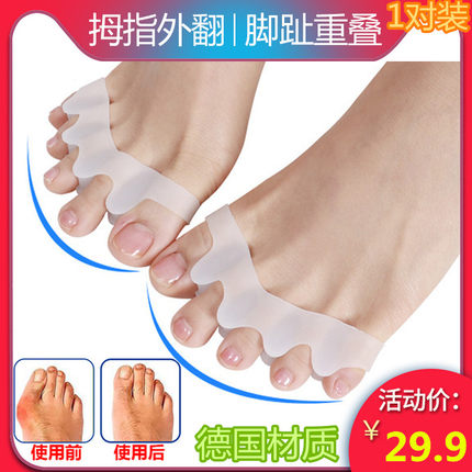 大脚趾拇指外翻矫正器日夜用成人可穿鞋男女儿童脚骨拇外翻分趾器