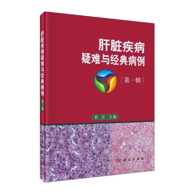 平装版-肝脏疾病疑难与经典病例  一辑 任红 科学出版社 本书可供肝病科医生研究生阅读 每个病例包括病例简介诊疗经过经验体会