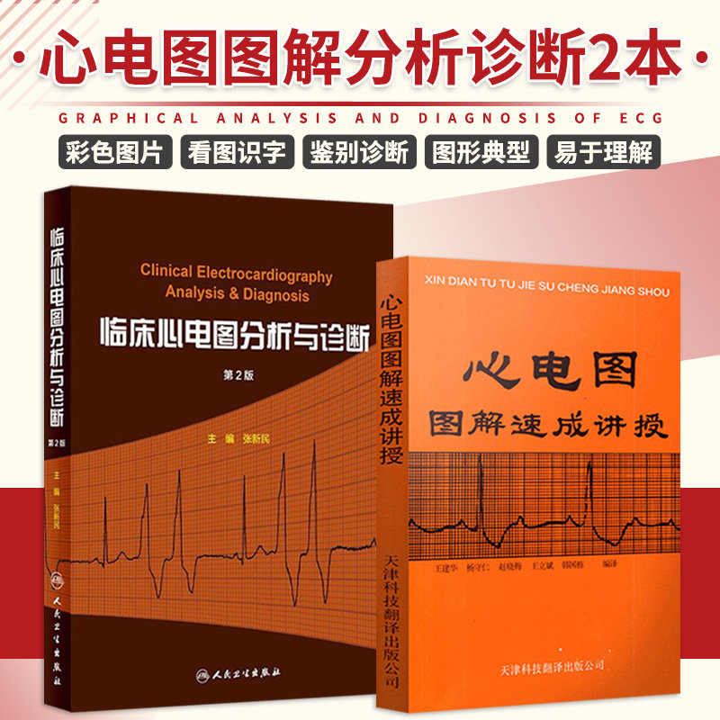 全2册 心电图图解速成讲授+临床心电图分析与诊断 第2版 医学院校的学生 各科临床医师以及基层卫生工作者学习心电图的选择
