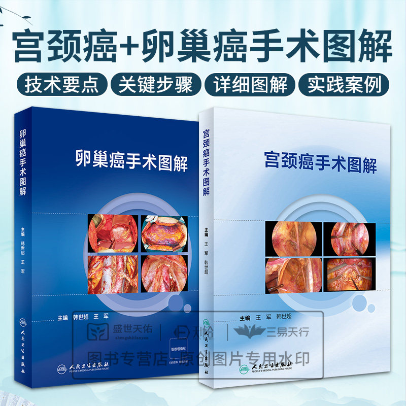 宫颈癌手术图解+卵巢癌手术图解 2本套装 子宫切除手术图解淋巴结切除腹腔镜机器人手术入路盆腔超声刀书籍 人民卫生出版社