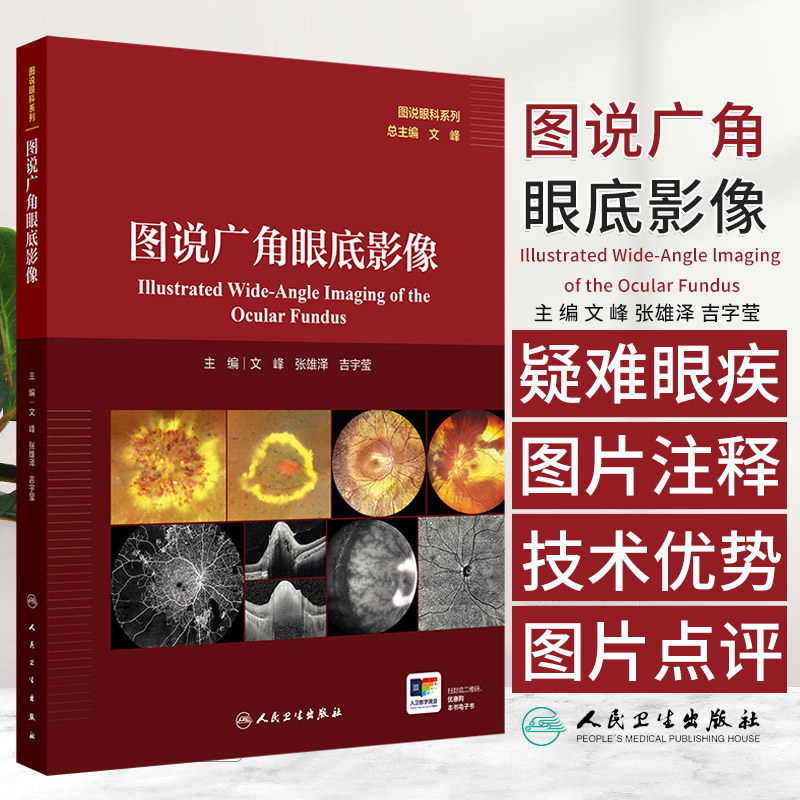 图说眼科系列:图说广角眼底影像 文峰等编 人民卫生出版社 脉络膜血管 遗传性视网膜脉络膜病变 急性中央旁中层黄斑病变