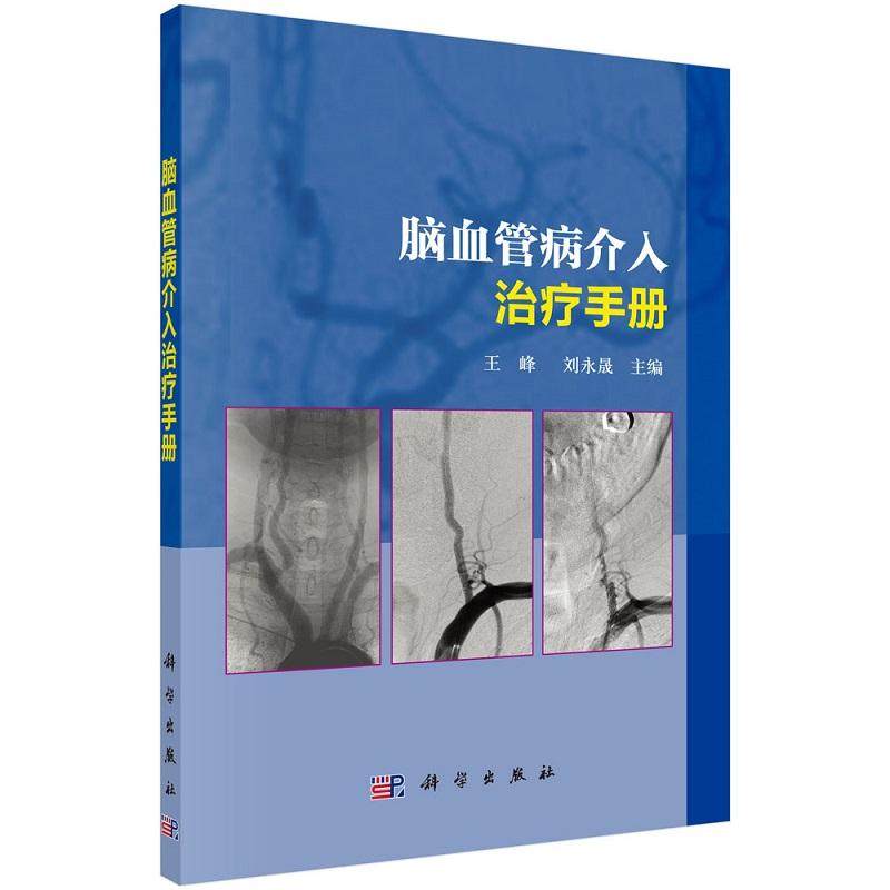 平装版-脑血管病介入治疗手册 刘永晟等 科学出版社 脑动脉狭窄 脑动脉瘤 脑动静脉畸形和硬脑膜动静脉瘘等脑血管病的治疗方法