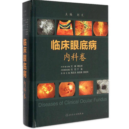 全新正版 临床眼底病 内科卷刘文/文峰/易长贤 精装版 可搭外科卷 人民卫生出版社