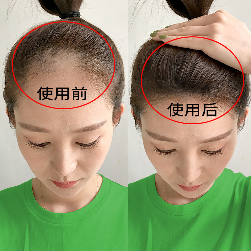 10天止脱半月生发 防脱固发专用 头发越洗越多 拥有黑密秀发 2发3