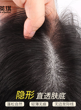 英琪假发片纳米头顶补发全真人发