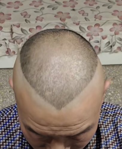 郭德纲短发模具造型头型