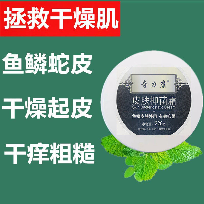 蛇皮肤鱼鳞皮肤霜去脱皮起皮干燥肤质保湿补水滋润肤腿部全身体乳